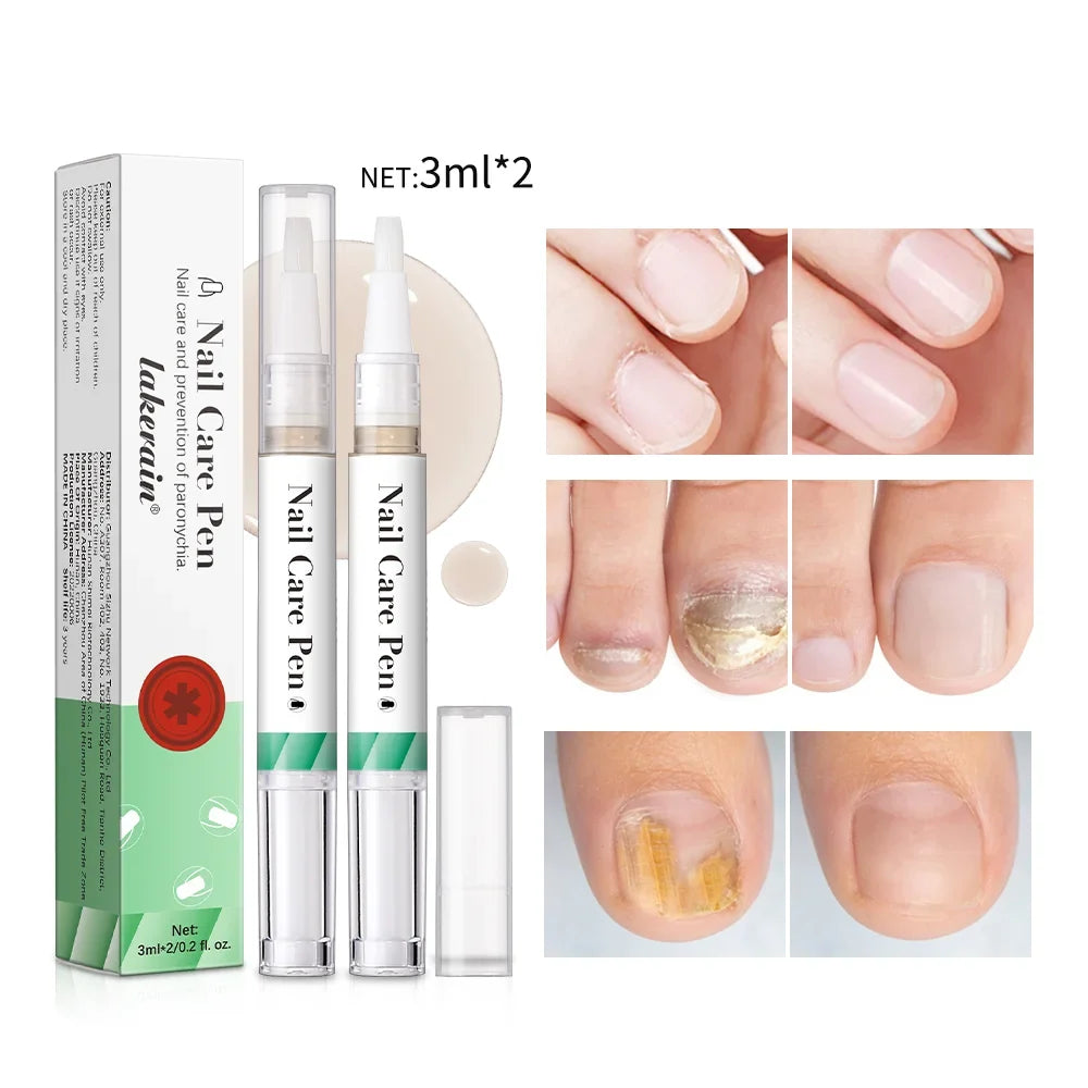 Nail Growth Cuticle Oil Pen – 2-Pack Nail Treatment | ibcccndc