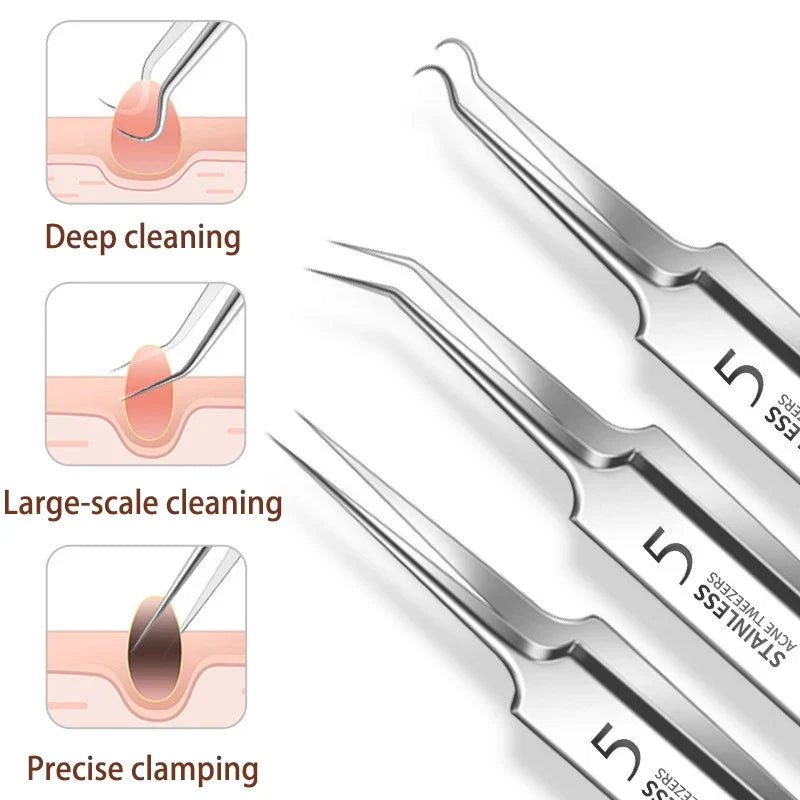 Blackhead Removal Tweezers Set – Stainless Steel Skin Care Tools